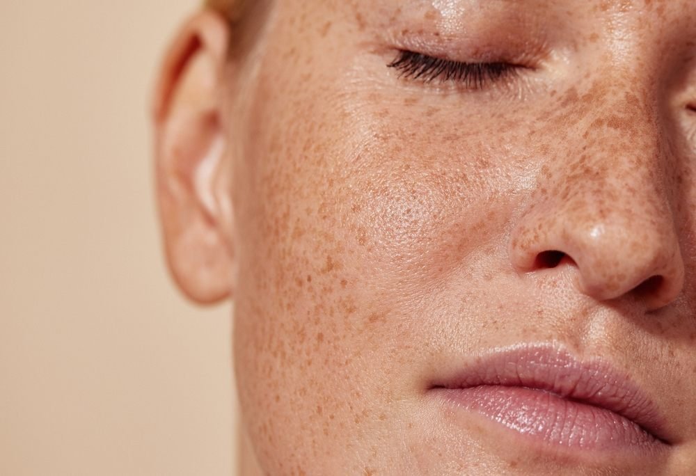 Close-up of natural skin texture and freckles